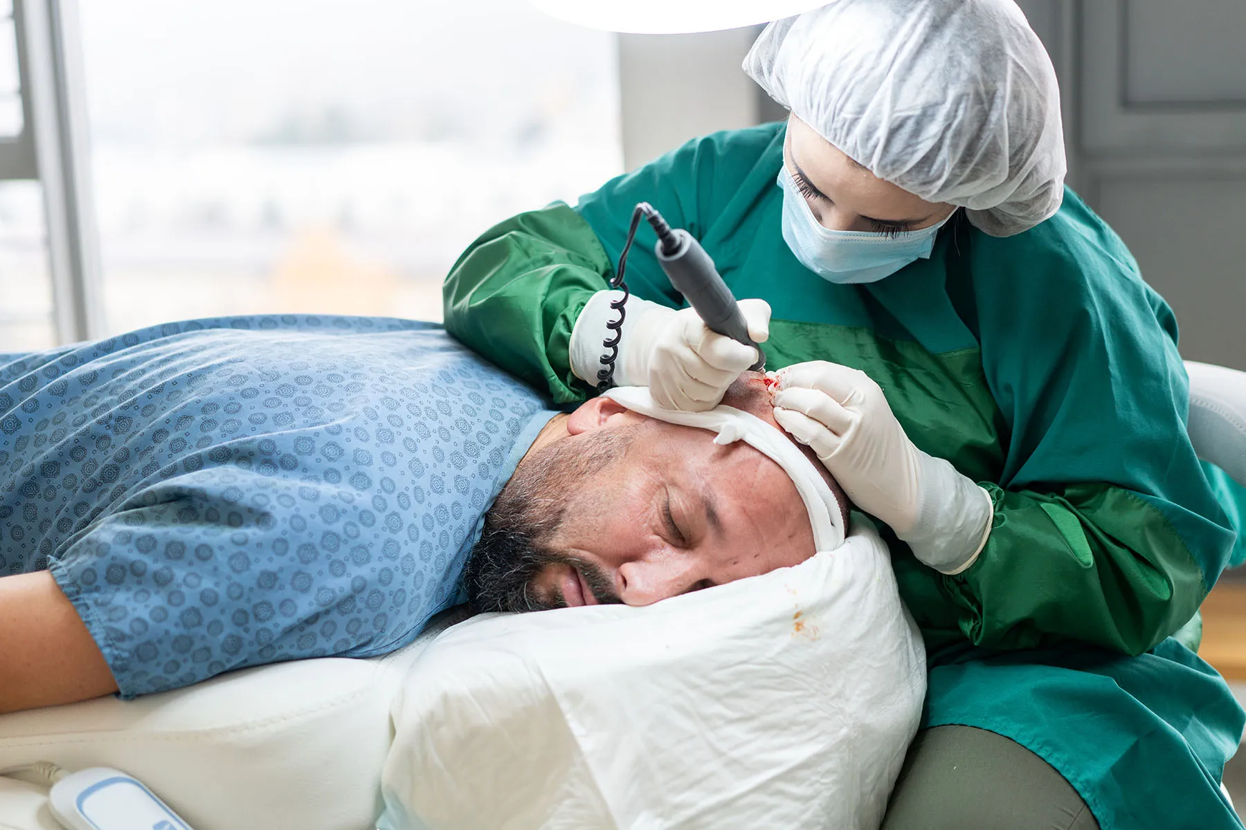 Hair Transplant UK Cost – Understanding Your Investment